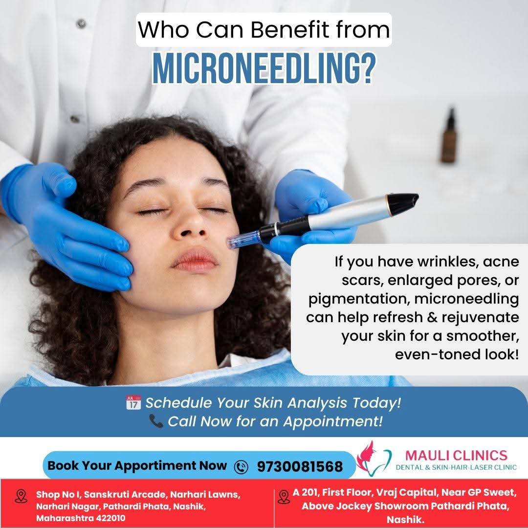 Best Microneedling Treatment in Nasik. We offer... main image