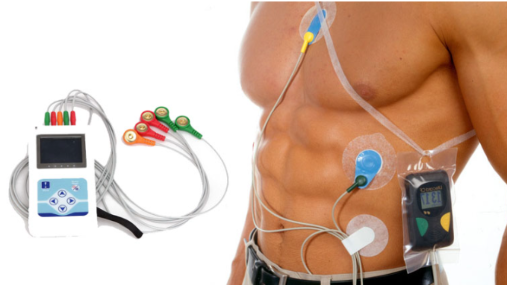 Holter Monitor Test 