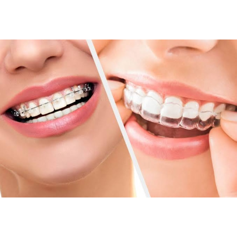 🦷 Transform Your Smile with Paras Dental Care! ... main image