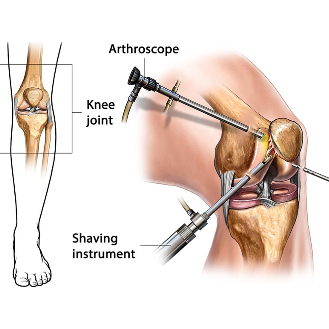 Best Joint Replacement and Arthroscopic Surgeries ... main image