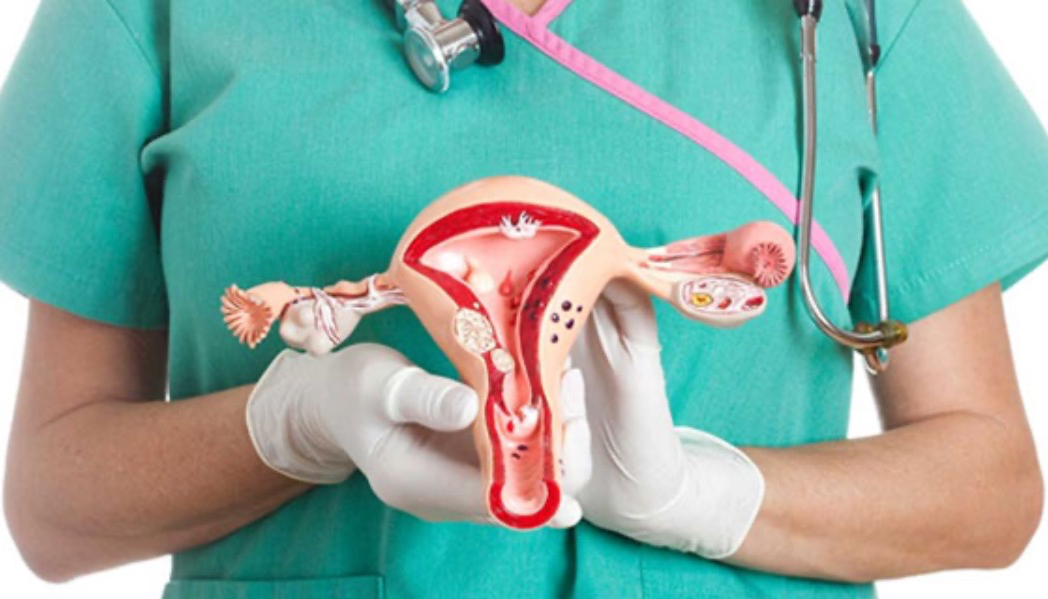 A hysterectomy is a surgical procedure to remov... main image