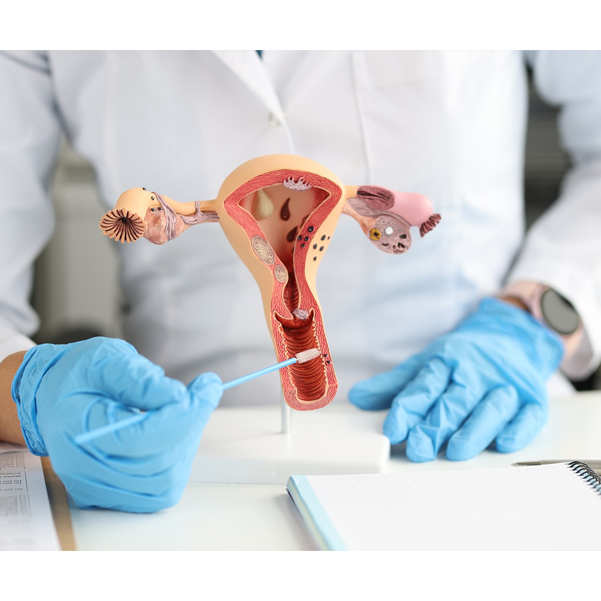 Surgical Approaches and Effects of Hysterectomy... main image