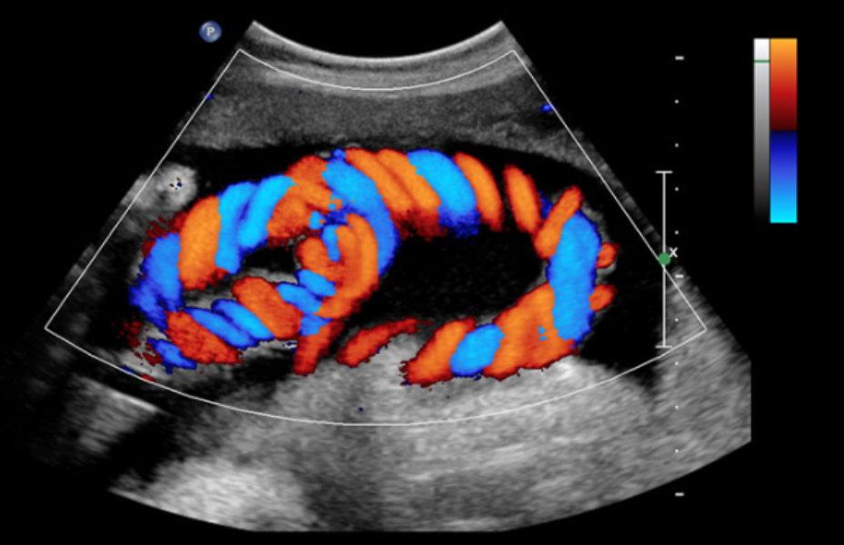 Color Doppler Test i