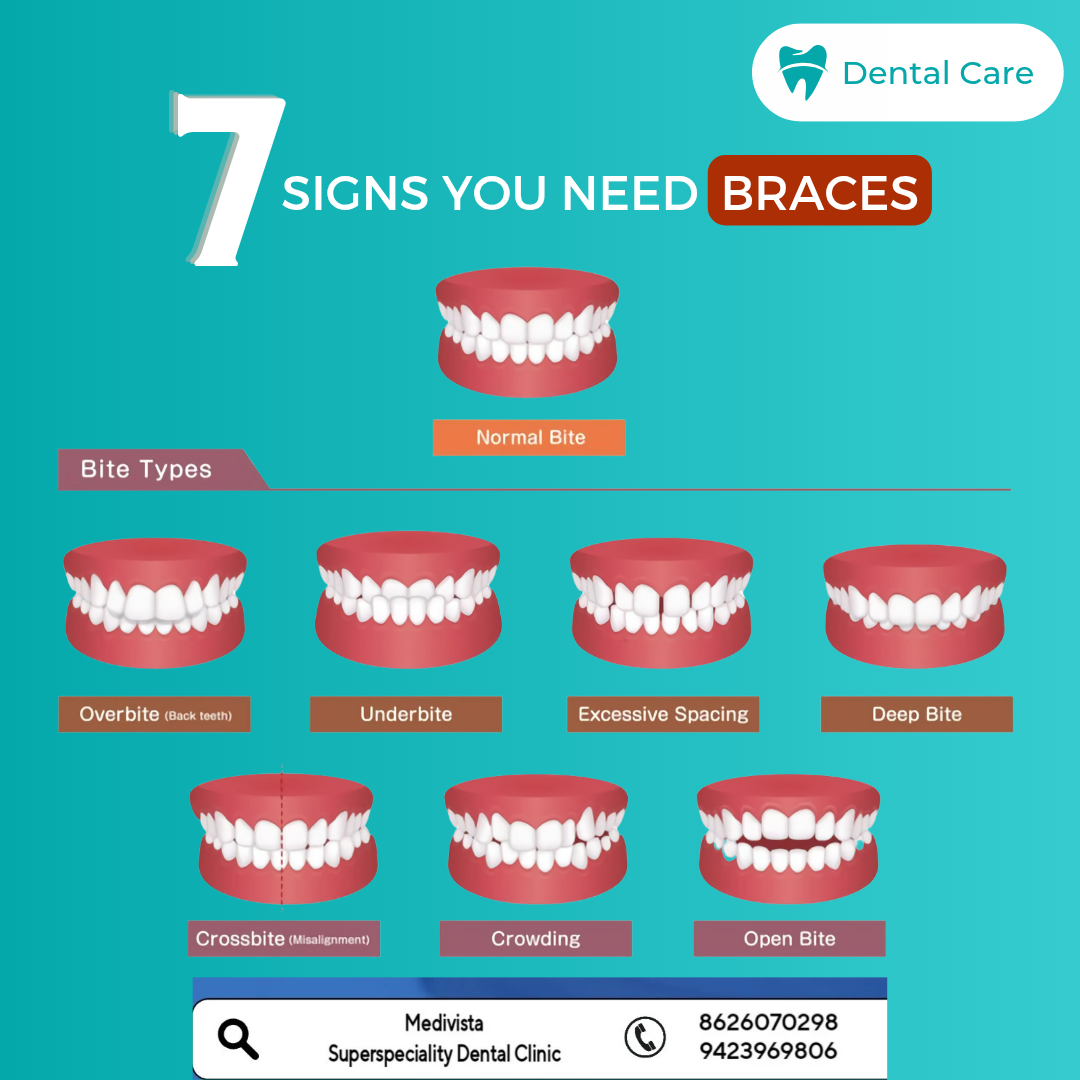 Thinking about getting dental braces but not su... main image