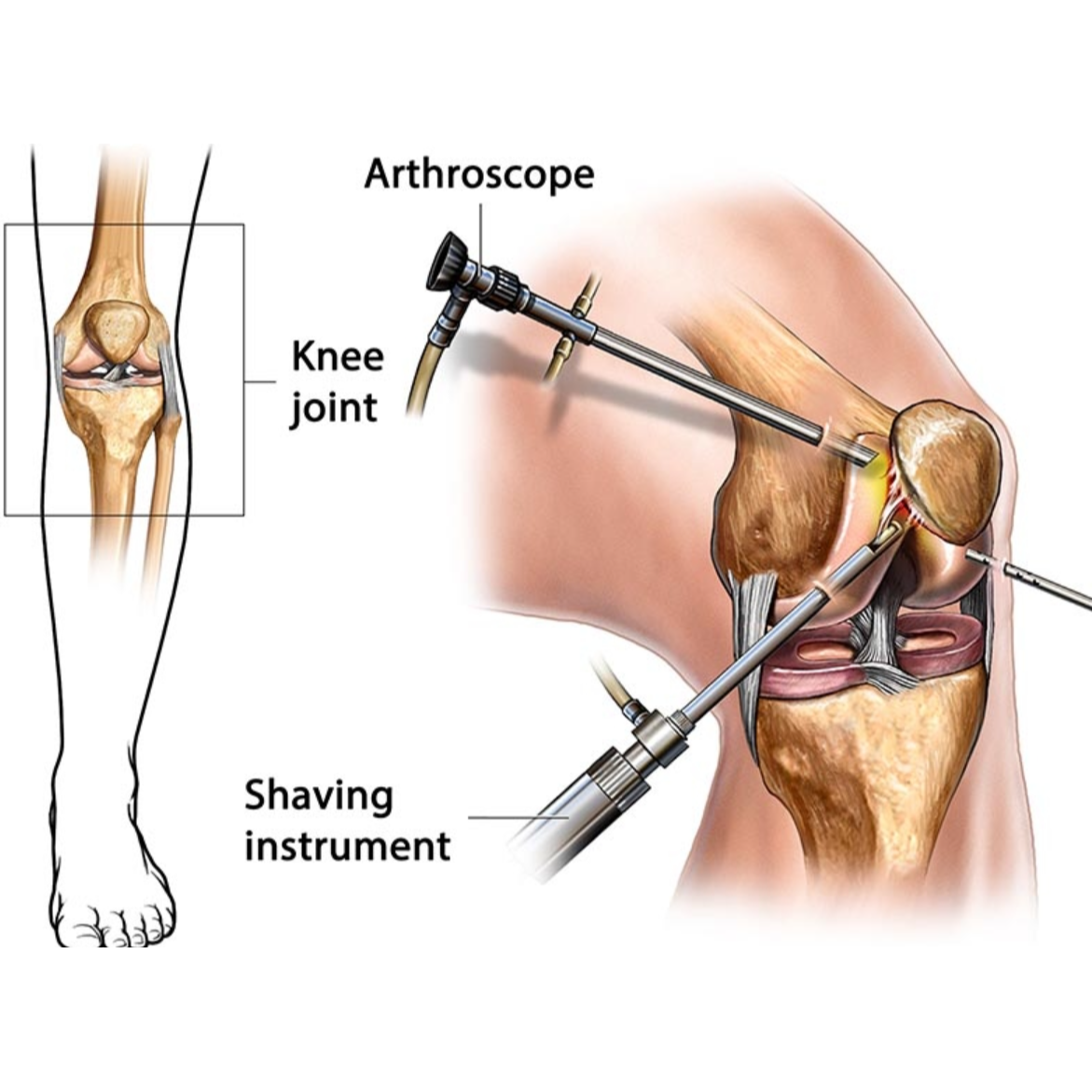 Best Joint Replacement and Arthroscopic Surgeries ... main image