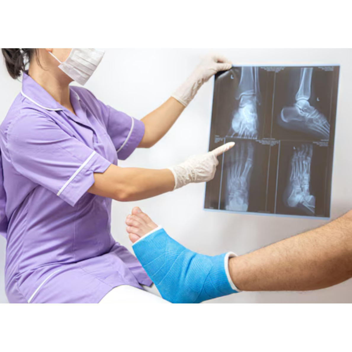 Best Fracture Management Surgery in Pimpri – Ay... main image