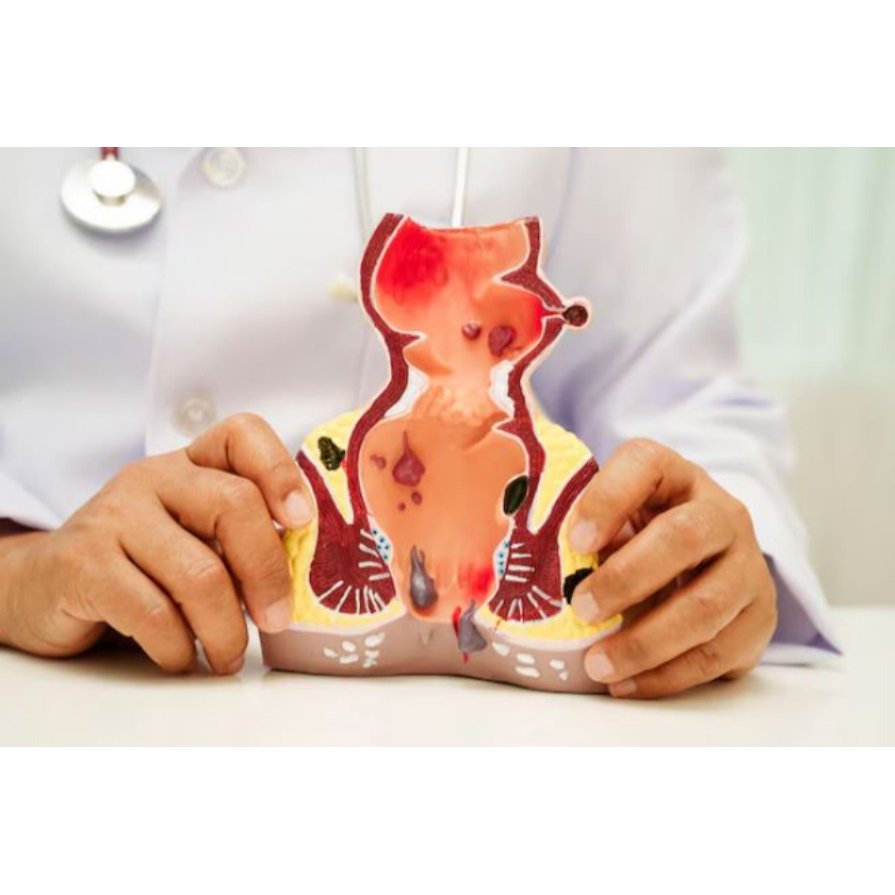 Proctologist in Guindy – Specialised Care for A... main image