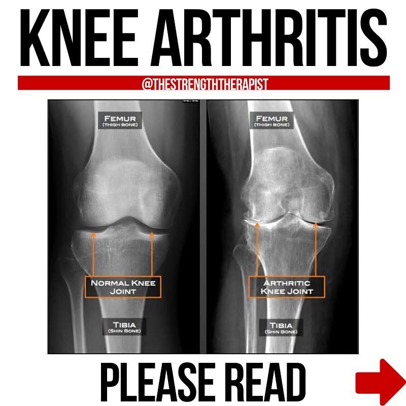 Physiotherapy clinic in Tambaram Are you Looking f... main image