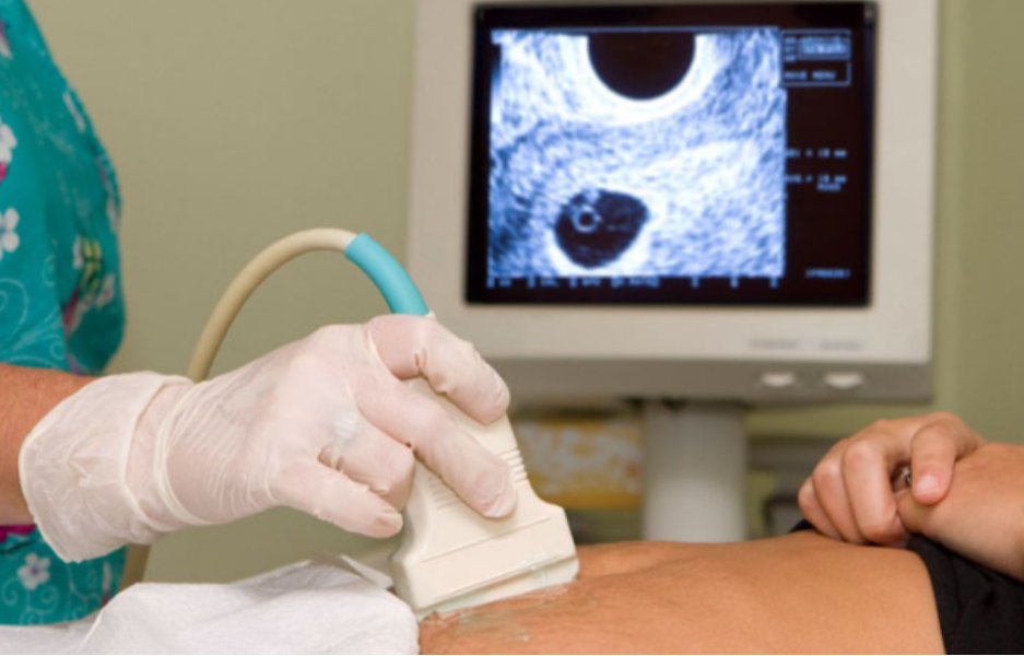 Ultrasound in Gurugram – Accurate Imaging for E... main image