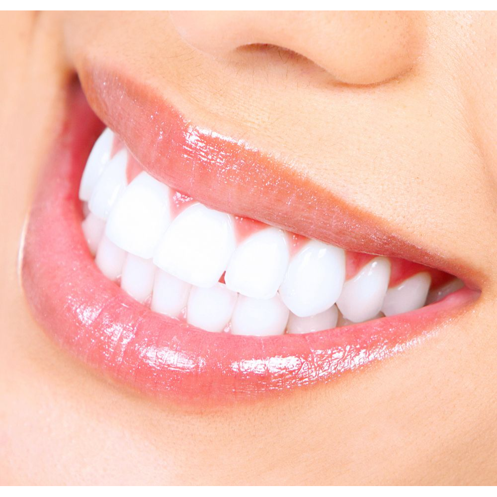 Teeth Whitening at Paras Dental Care – Best Tee... main image