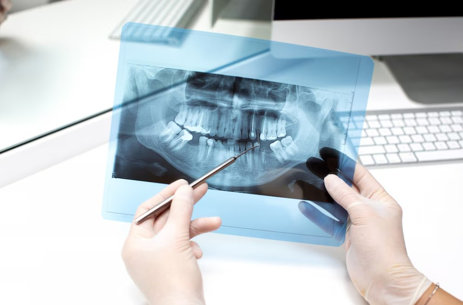 OPG (Dental Imaging) in Gurugram – Complete Ora... main image