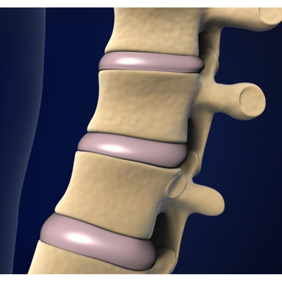 Best Cervical Disc Replacement in Nagpur Severe... main image