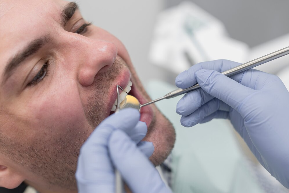 Gum Surgery in Nashik for Healthy Gums Healthy ... main image
