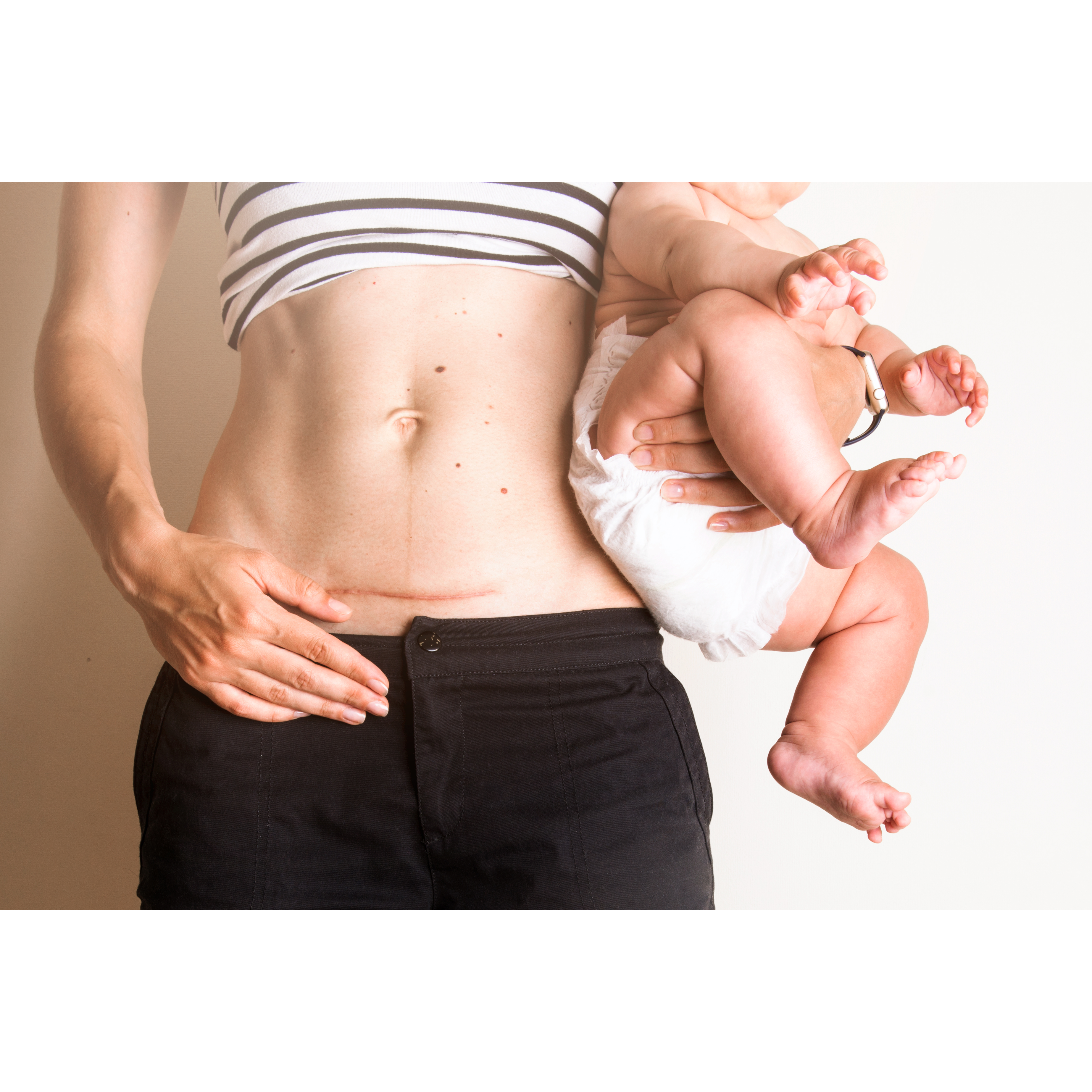 Cesarean Delivery in Lohegaon Pune: Safe and Sp... main image