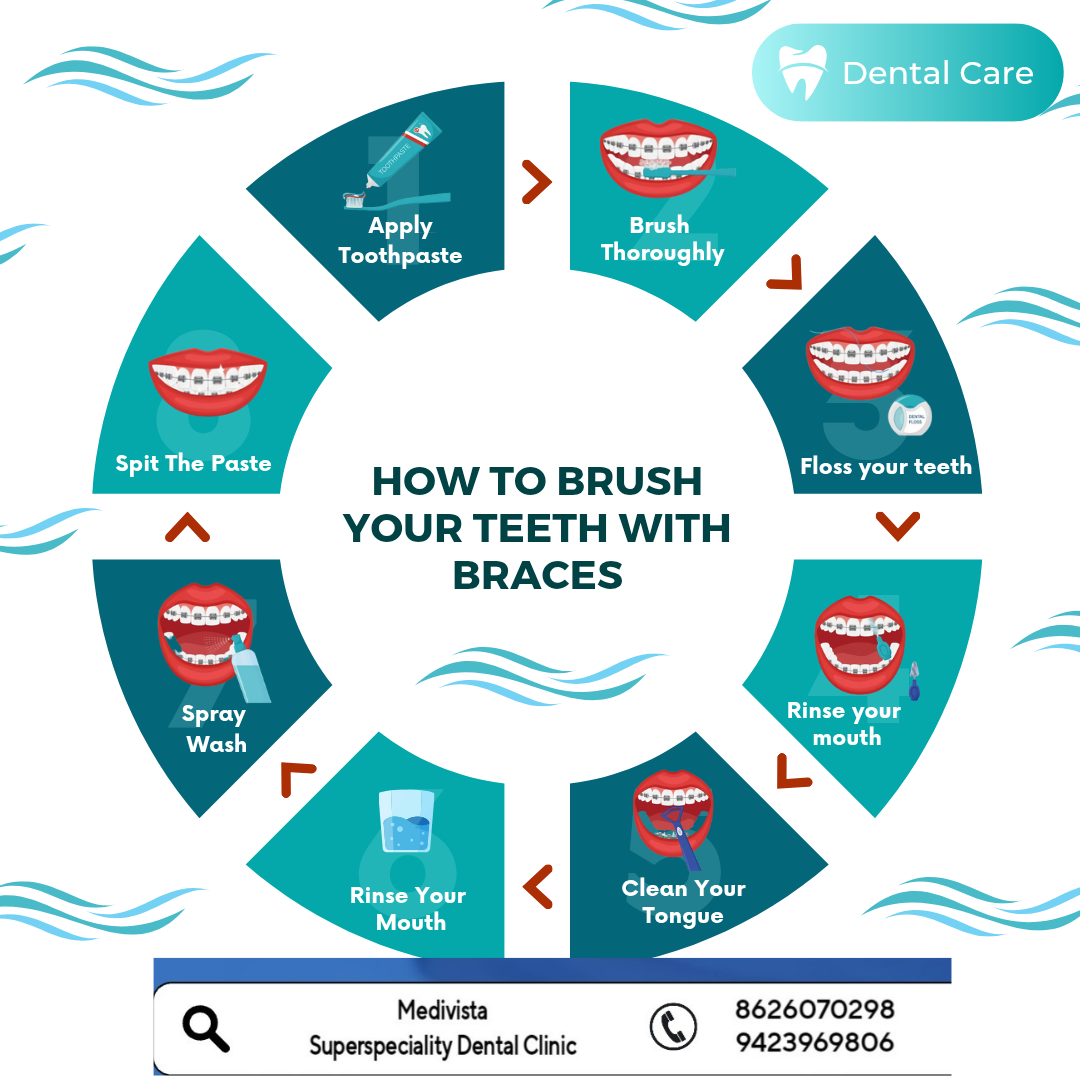 Dreaming of a Perfect Smile? Let Braces Do the ... main image