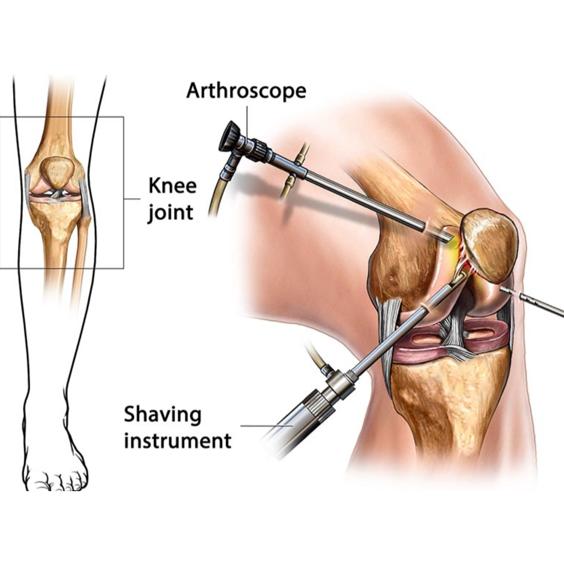 Best Joint Replacement and Arthroscopic Surgeries ... main image