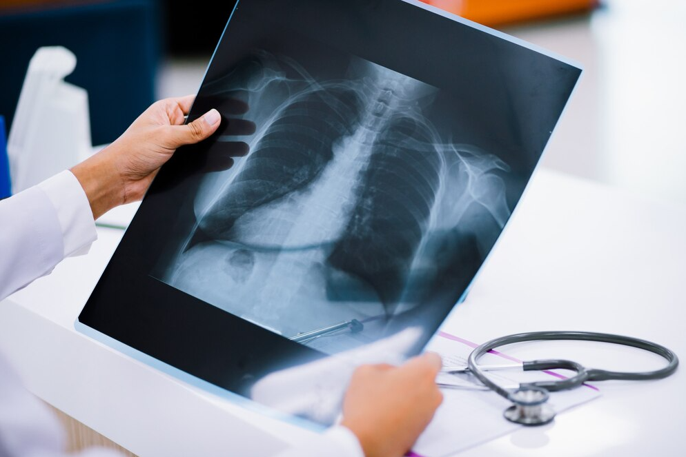Digital X-Ray in Gurugram – Fast, Clear, and Ac... main image