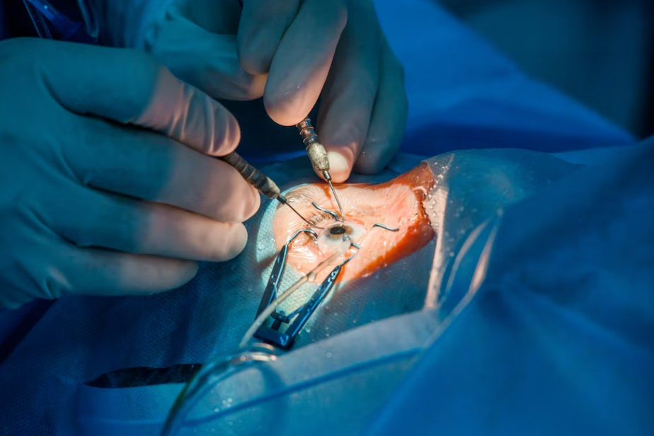 Retina Surgery Experts in BTM Layout Retina sur... main image