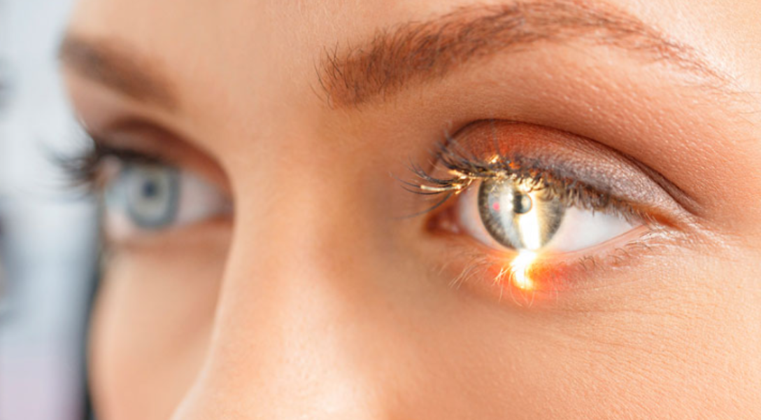 Eye Care in Gurugram – Expert Vision Services G... main image