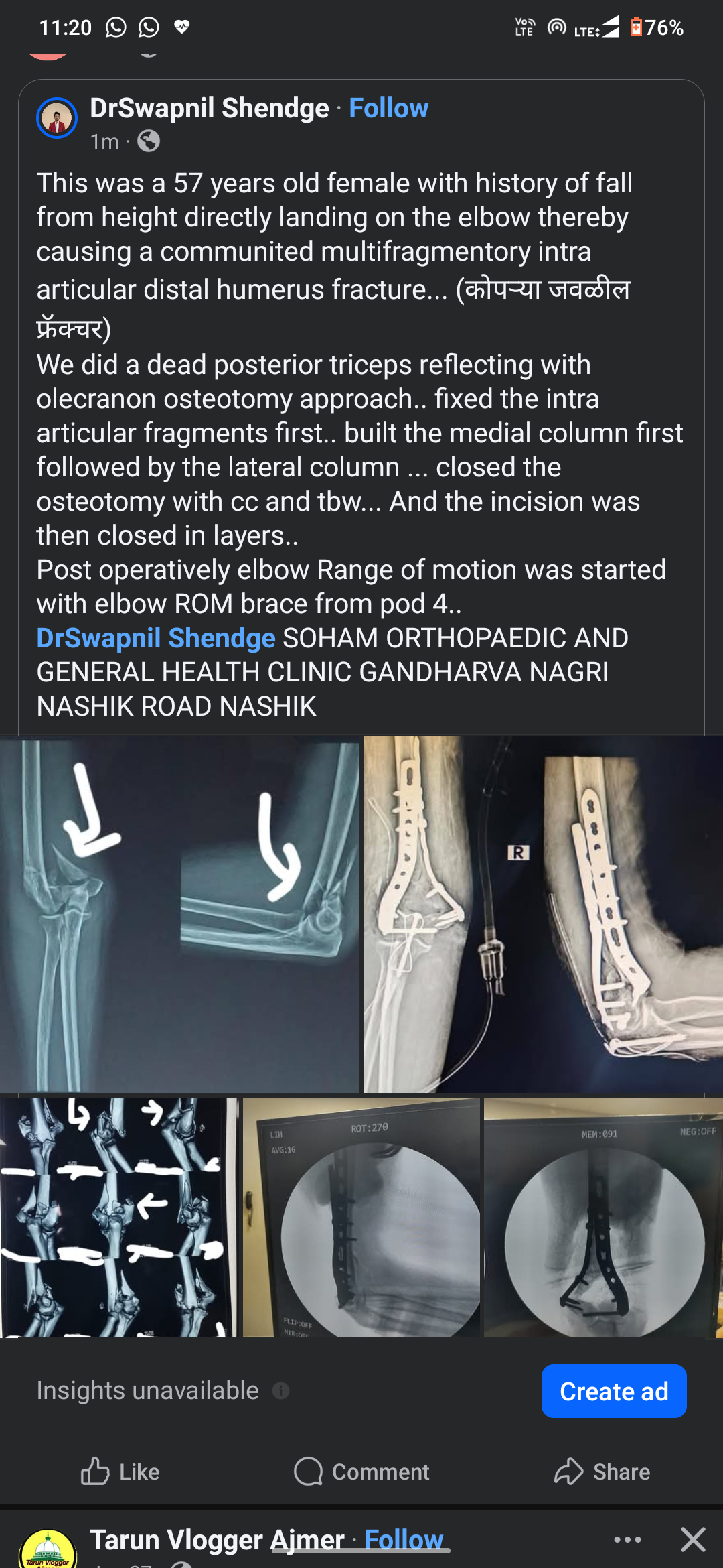 A new case that we posted main image