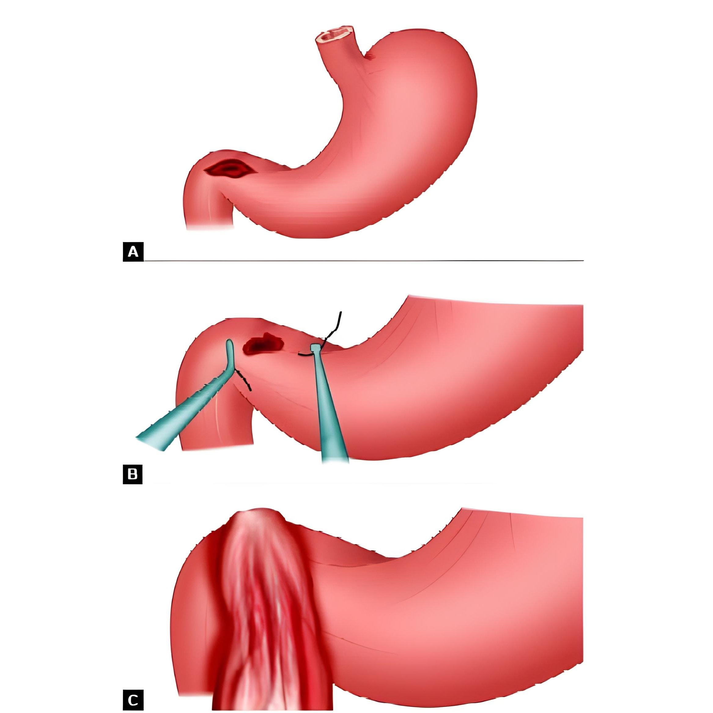 update image