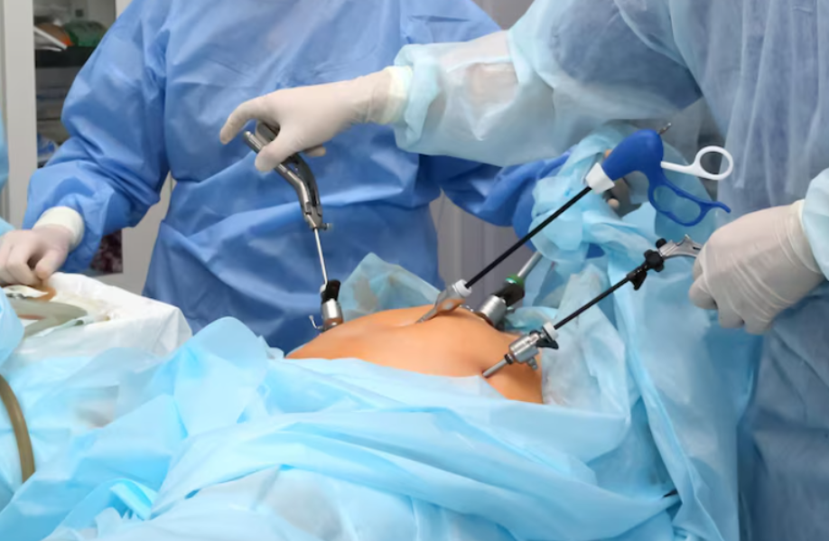 Laparoscopic Surgery Expertise in Vashi Mumbai May... main image