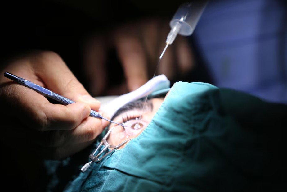 Best Cataract Surgeon in JP Nagar Choosing the ... main image