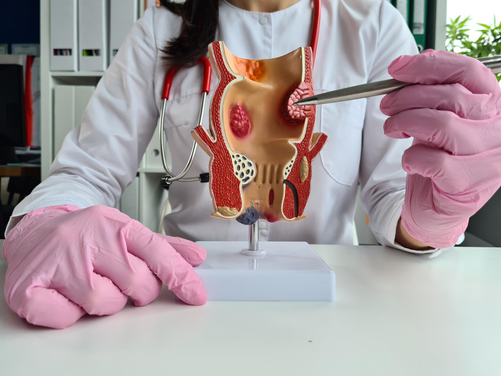 Laser Treatment for Piles in Velachery, Chennai... main image
