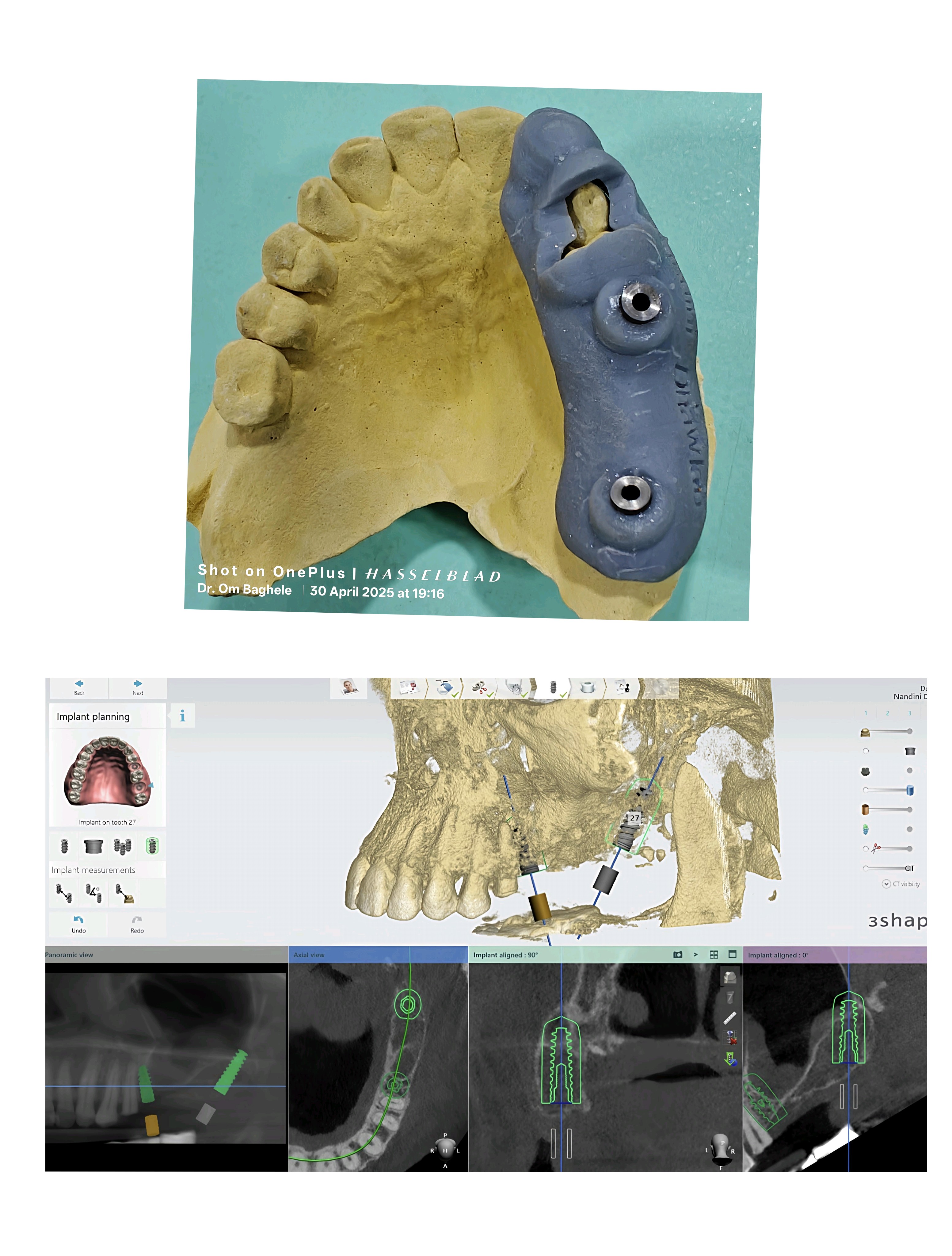 Digital Plan & Surgical Guide Digital technolog... main image