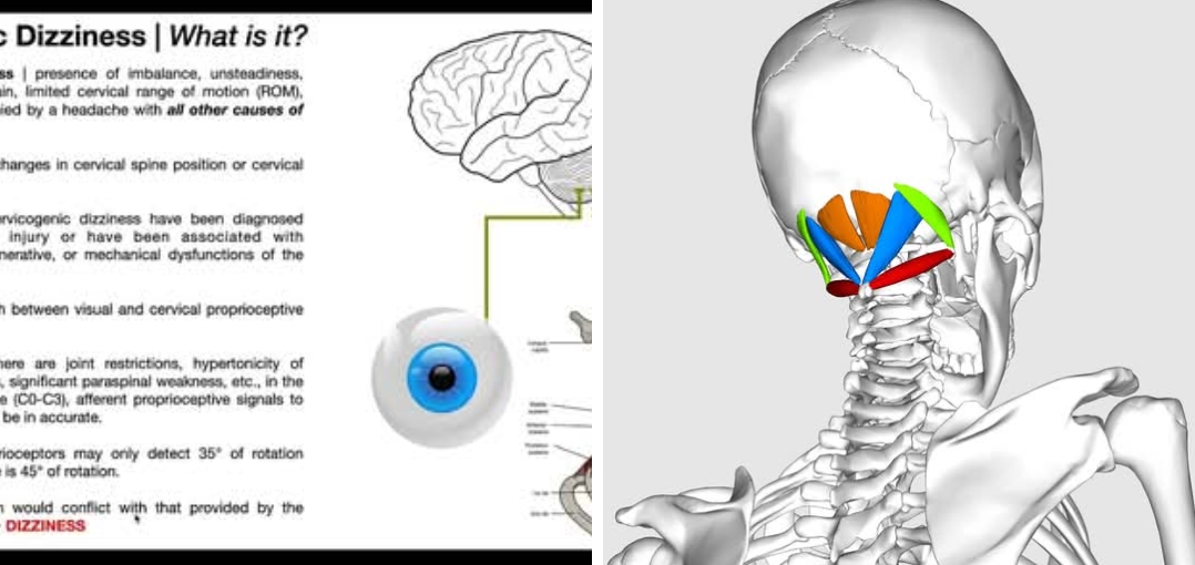 The role of the suboccipital (SO) muscles in balan... main image