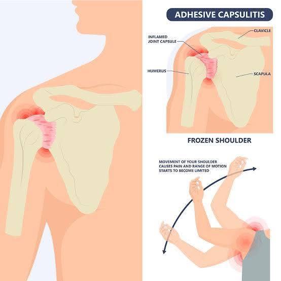 Physiotherapy clinic in Tambaram Are you Lookin... main image