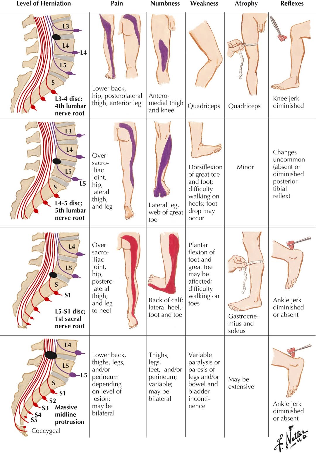 BREAKING: NON SURGICAL Solution for Complicated Ba... main image