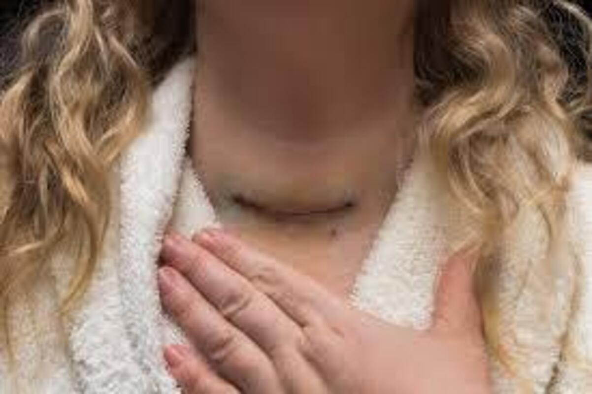Thyroid Surgery in Dwarka, Delhi: Precision Care f... main image