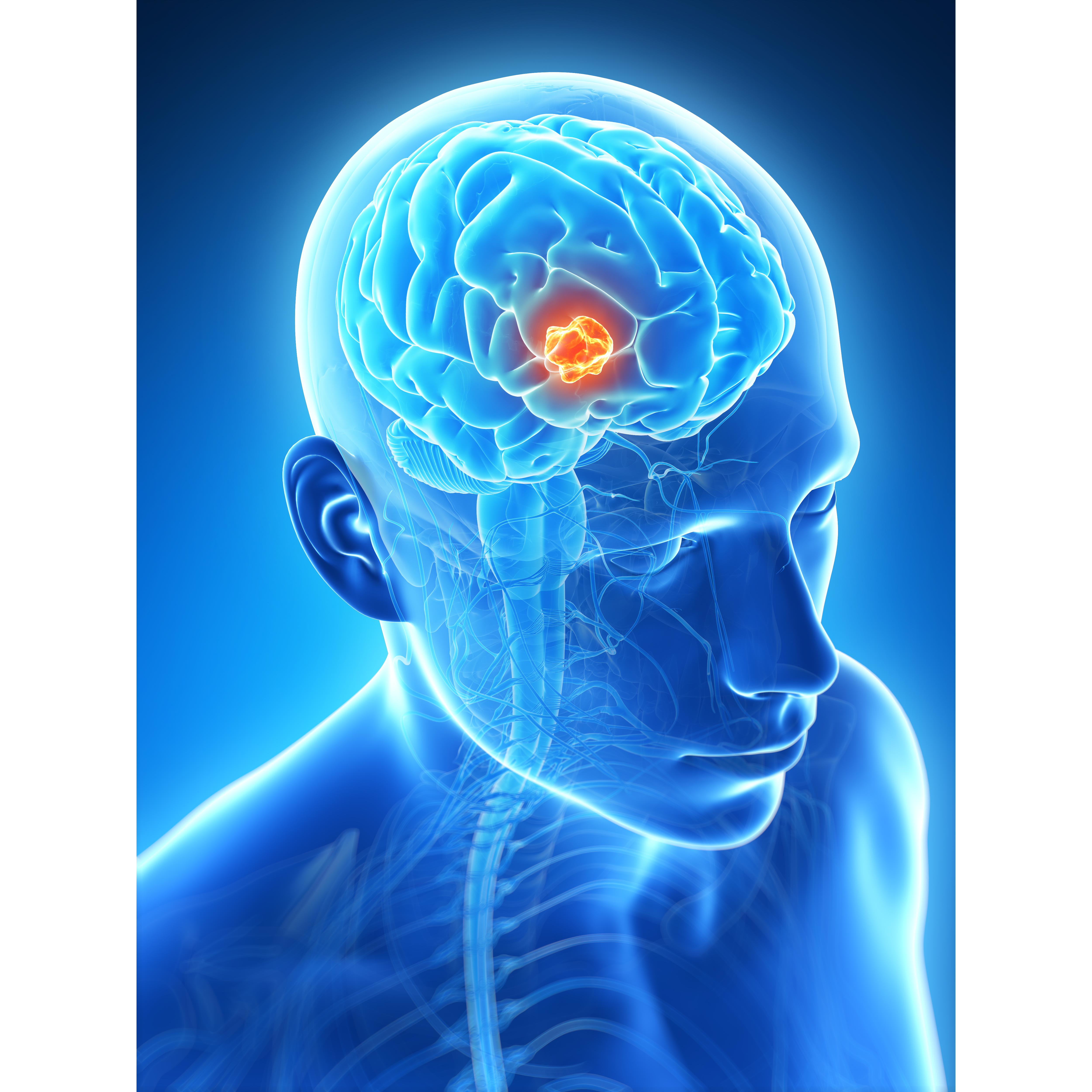 Best Surgeon for Brain Tumor in Jaipur with Proven... main image