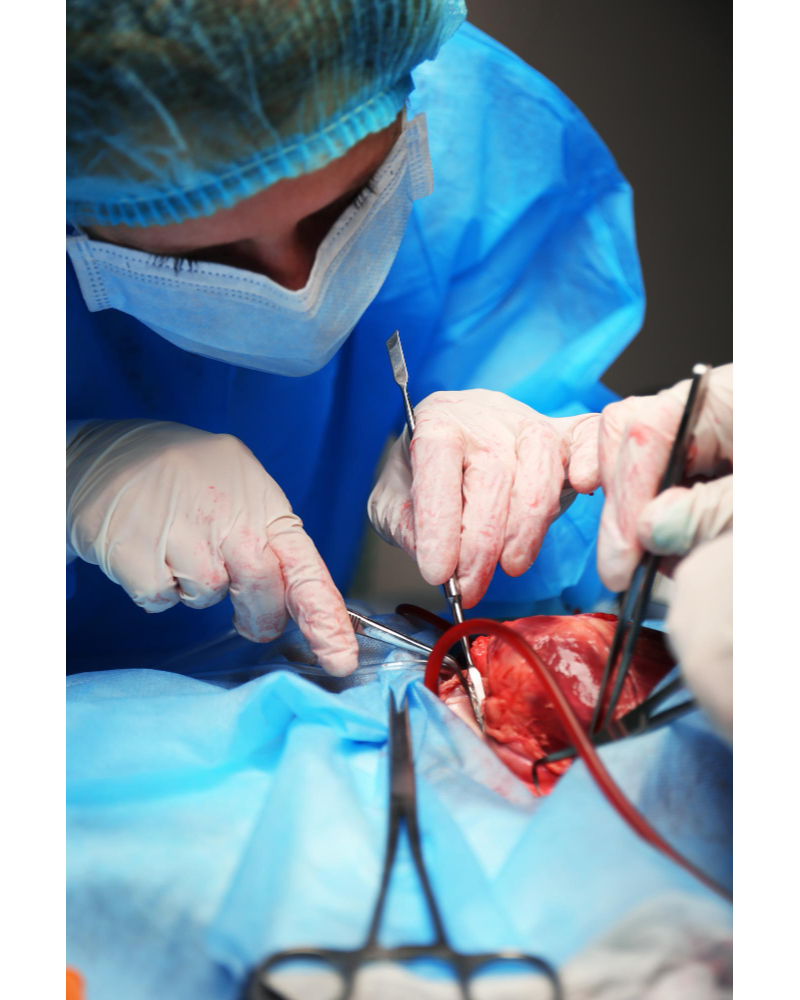 MICS CABG in Nagpur MICS CABG (Minimally Invasi... main image