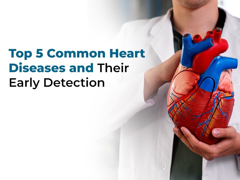 👉 The Importance of Early Detection in Heart Di... main image