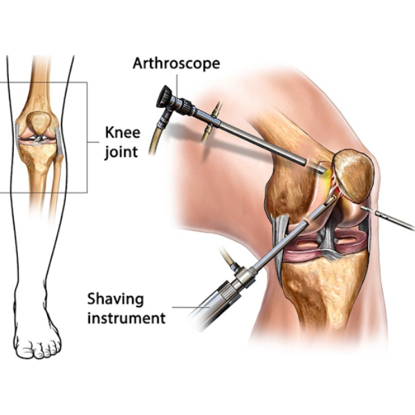 Best Arthroscopy and Sports Medicine in Chinchw... main image