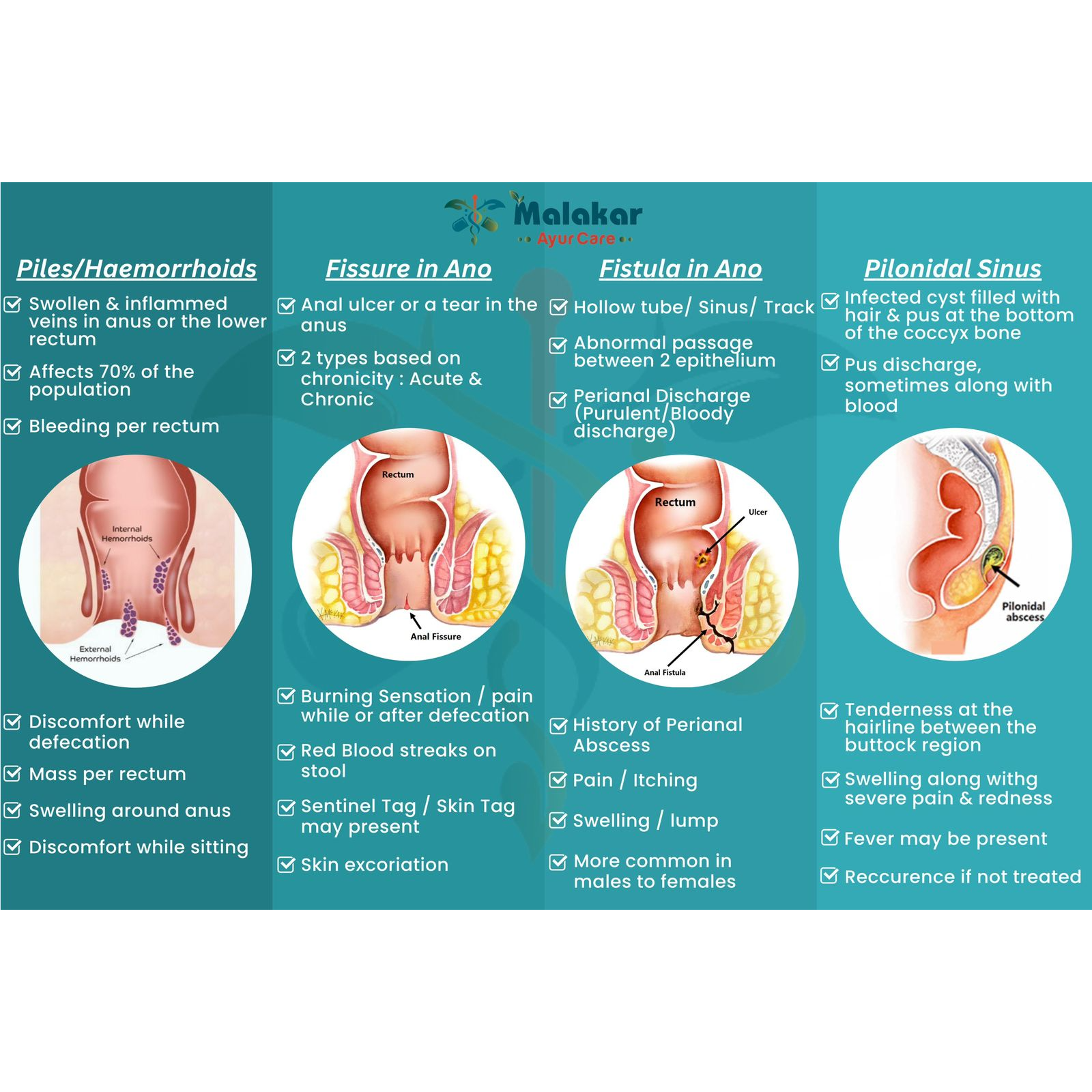 fistula treatment center in trichy
Malakar Ayur Ca... main image