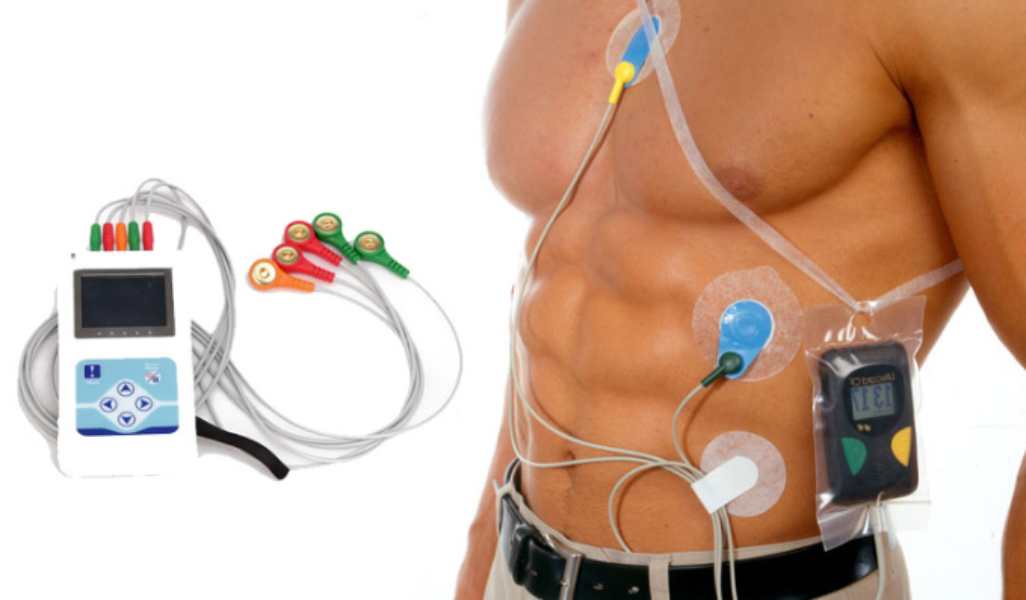 Holter Monitor Test 