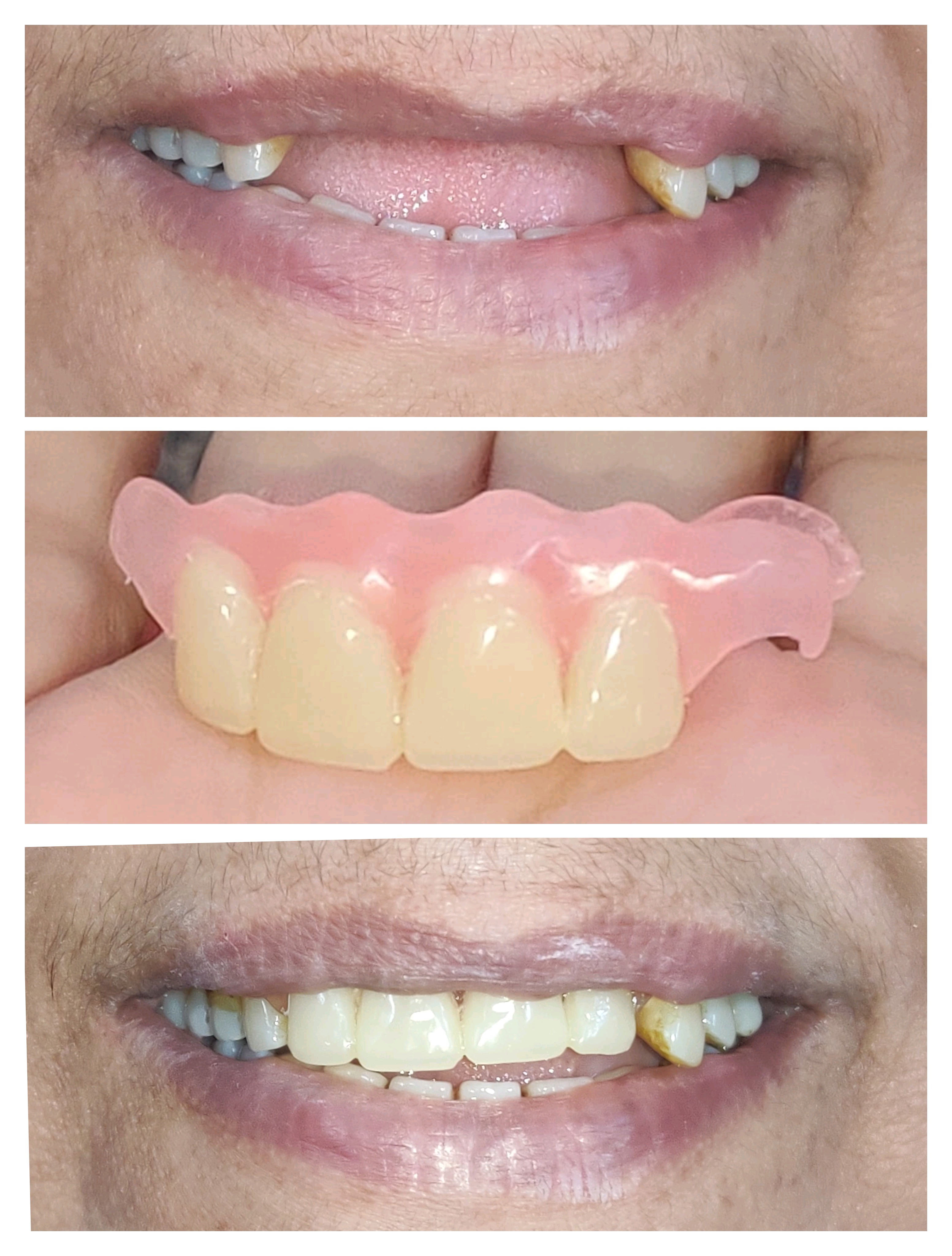 Affordable dentures near me Best denture clinic... main image