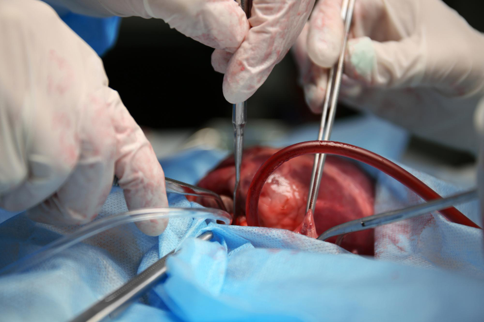 Small Incision Cardiac Surgery in Nagpur Small ... main image