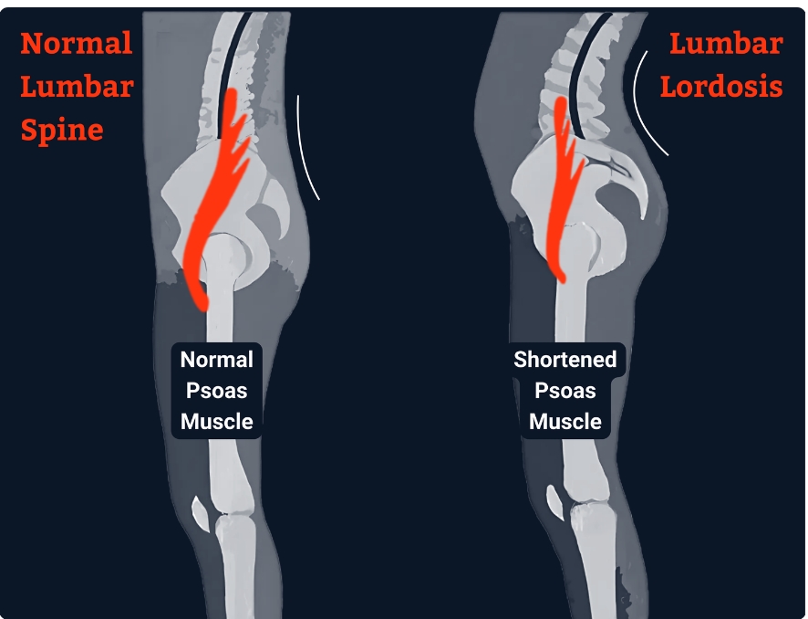 Psoas Talk with Christye: Is Your Athlete's Hip Pa... main image