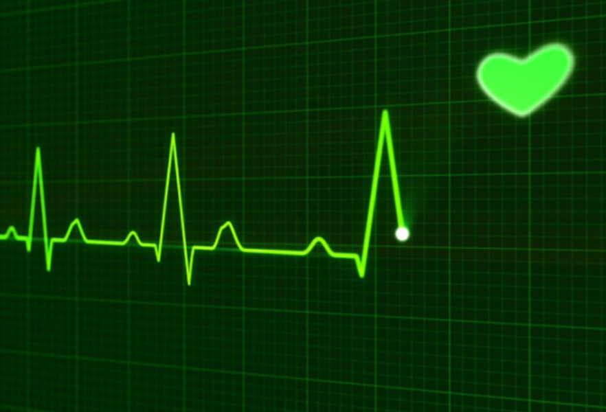 ECG (Electrocardiogr