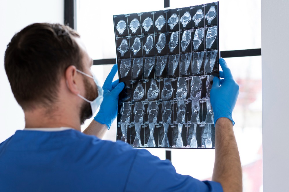 Best X-Ray Services in New Delhi Accurate diagn... main image