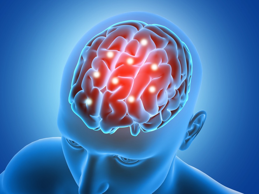 Surgeon for Brain Aneurysm in Jaipur with Advanced... main image
