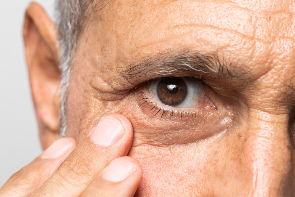 Hypertensive Retinopathy Treatment in Nagpur – ... main image