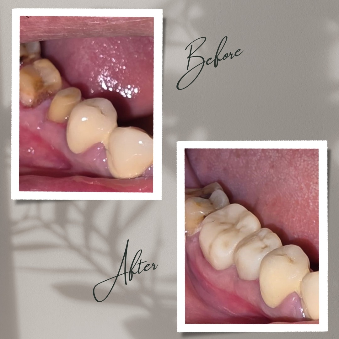 update image