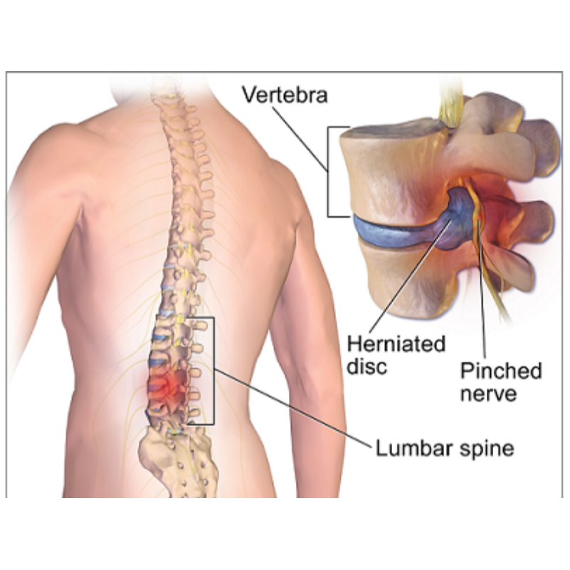Spine Surgeon in Gaur City main image