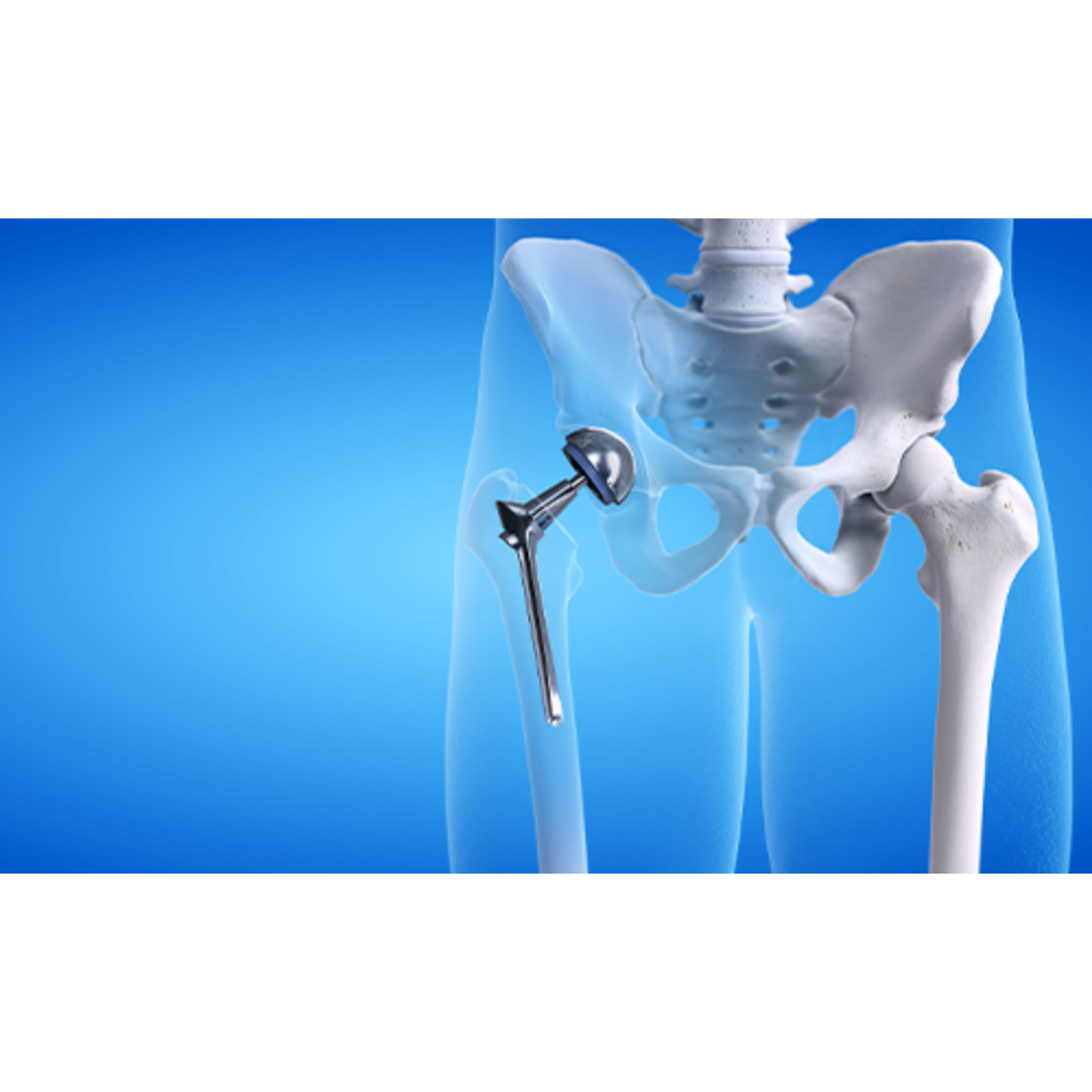 Hip Replacement Surgeon in Gaur City main image