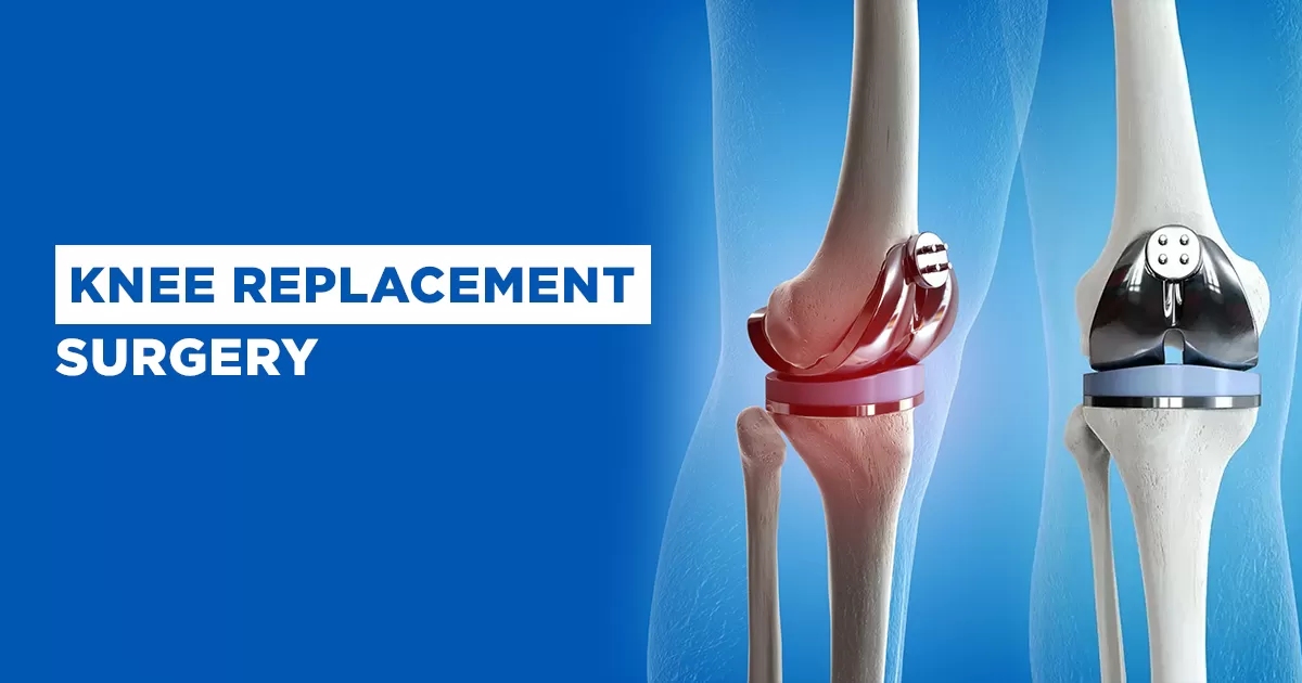 Knee Replacement Surgeon in Gaur City main image